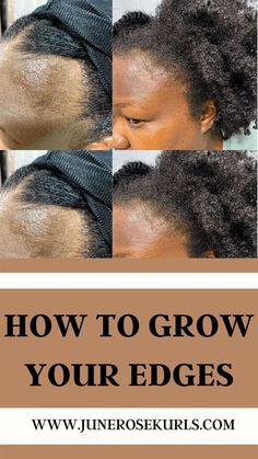 Hairstyles To Help Edges Grow, Natural Hair Edges Growth Tips, Growing Back Edges, Hair Edges Growth Tips, Grow Back Edges Hair, Edges Growth For Natural Hair, Regrow Edges Natural Hair, Thinning Edges Black Hair Growth, Hairline Growth Black Hair