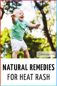 Natural Remedies for Heat Rash (Prickly Heat) in Kids. Don't Let heat rash ruin your summer! #parenting #healthykids #kidshealth #kidsrashes #naturalremedies Remedies For Heat Rash, Counsellors Office, Children Health, Natural Remedies For Migraines