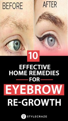 Thinning Eyebrows, Eyebrow Regrowth, Eyebrow Hair Growth, Natural Eyebrows Growth, Grow Eyebrows Thicker, Shaped Eyebrows, Fuller Eyebrows