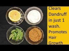 Home Remedy For Dandruff, Remedy For Dandruff, Promote Hair Growth, Natural Cough Remedies, Eating Organic, Natural Health Remedies