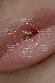 Lip Filler Social Media, Botox Education, Lip Filler Quotes, Botox Vs Fillers, Lip Filler Aesthetic, Medspa Aesthetic, Glossy Aesthetic, Fillers Aesthetic, Botox Quotes