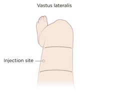 the side view of an arm and its insertion site