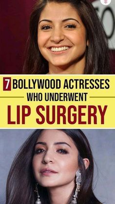 an advertisement for lip surgery with the caption'hollywood actresses who underview lip surgery '