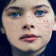 Nathaniel Hawthorne made a name for himself with the novel The Scarlet Letter. But he also wrote several short stories. “The Birthmark” dives into the damages of perfectionism within a… Girl With Freckles, Blue Eyes, Blue