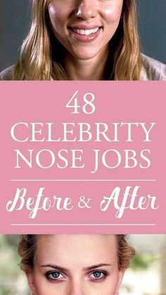 Best Rhinoplasty Before After, Celebs With Big Noses, Celebrities With Big Noses, Wide Nose Women, Women With Big Noses, Nose Job Before And After, Blake Lively Nose, Big Nose Women, Celebrity Nose Jobs