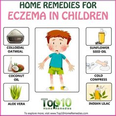 Here are some home remedies for eczema in children with moisturizers, oils, colloidal oatmeal, probiotics, and more. Natural Acne Remedies, Home Remedies For Acne, Natural Health Care, Natural Drinks, Cold Home Remedies, Acne Remedies, Skin Remedies, Natural Health Remedies, Natural Home Remedies