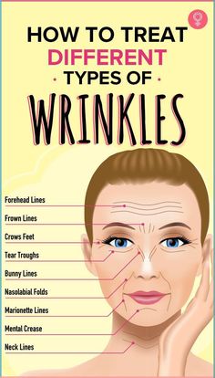 Get Rid Of Forehead Wrinkles Home Remedies For Wrinkles, Wrinkle Remedies, Wrinkle Free Skin, Facial Wrinkles, Nasolabial Folds, Under Eye Wrinkles, Forehead Wrinkles, Skin Care Wrinkles, Star Eyes