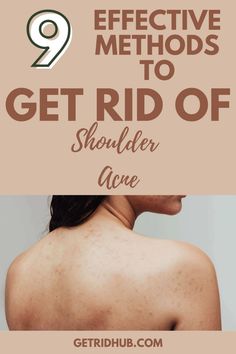 Learn effective ways to get rid of acne on shoulders. Discover tips and treatments to clear shoulder acne and achieve smooth, blemish-free skin. Shoulder Acne, Peroxide Uses, Acne Causes, Best Sunscreens, New Skin