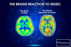 Listening To Music Reaction Pic, Music Reaction Pic, Music And The Brain, Soren Kierkegaard, Brain Facts, Language Centers, Cognitive Science, Improve Brain Function