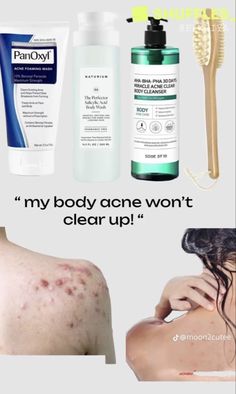 Easy Routine, Micro Needling, Hydrated Lips, Skin Care Basics, Skin Care Routine Order, Beautiful Skin Care, Lip Care Routine, Serious Skin Care