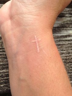 a person's wrist with a cross on it