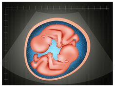 the fetuses are shown in an image with blue and pink colors on it