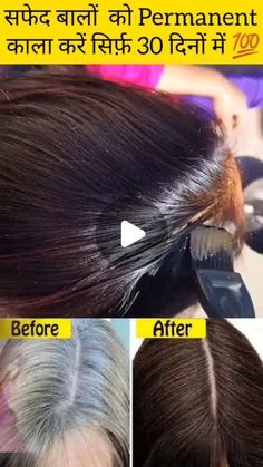 White Hair Solution, Neha Sharma, December 31, Hair Care Routine, Hair Care Tips, Natural Hair Care, White Hair, Follow For More