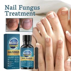 1 PC Nailpolish Remover Londontown Kur Toe Nails Toenail Softener Nail Strengthener For Damaged Nails Nail Oul Size: One Size.  Color: Blue. Nail Filler, Toenail Health, Nail Hardener, Glass Nail File, Athletes Foot, Nail Repair, Damaged Nails, Cuticle Remover, Nail Remover