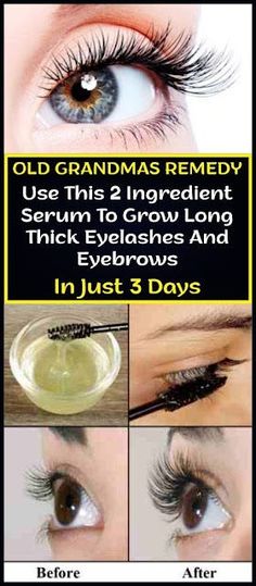 Grow Longer Thicker Eyelashes, Make Hair Grow Faster, Long Thick Eyelashes, Quick Hair Growth, Diy Serum, Eyelashes And Eyebrows, Thick Eyelashes, Make Hair Grow, Skin Care Routine For 20s