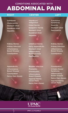 Conditions Associated With Abdominal Pain Inforgraphic Medical Assisting, Homeopathy Remedies, Nursing School Survival, Nursing School Studying, Nursing School Tips, Nurse Office, Medical School Studying, Nursing School Notes