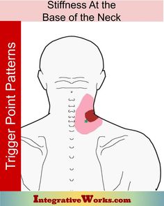 Pain at the Base of the Neck When Turning - Integrative Works Shoulder Blade Muscles, Muscles Of The Neck, Throbbing Headache, Neck Problems, Psoas Muscle