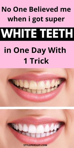 How to Whiten Teeth at Home: Teeth Whitening Remedies That Really Work Grow Hair Overnight, Discolored Teeth