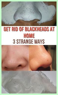 Glass Skin Challenge, Skin Challenge, Clear Skin Remedies, Pore Tightening, Skin Face Mask, Workouts For Beginners, Get Rid Of Blackheads, Large Pores, Skin Remedies