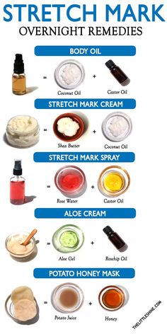 Stretch marks are more common than you think and can be a result of sudden weight gain or weight loss, pregnancy, obesity, contraceptive medicine side Overnight Remedies, Aloe Cream, Marks Cream, Potato Juice, Lotion For Oily Skin, Ayurvedic Remedies