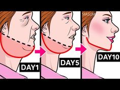 a woman's face is shown with arrows pointing to the different stages of her nose