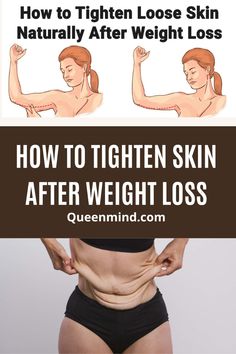 Learn How to tighten skin after weight loss! Diy tightening stomach exercises that work. Do you have loose skin after pregnancy? Learn how to How to minimize loose skin after weight loss. Loose Skin Belly Workout, Toning Loose Skin On Stomach, Exercises For Loose Skin, Loose Tummy Skin, How To Get Rid Of Excess Skin On Belly, Loose Inner Thigh Skin, Tone Loose Belly Skin, How To Firm Loose Skin On Stomach, Saggy Stomach Skin