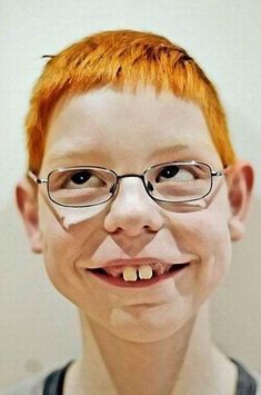 a young boy with red hair and glasses smiling