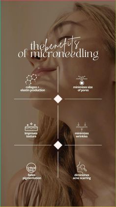 Highland Medical Aesthetics | Flowood Mississippi   A totally non-surgical procedure, the Morpheus8 uses both radiofrequency and micro-needling for skin remodeling. No downtime is associated, safe on any skin type and can be used on patients that just took sun the same day! Medspa Instagram Stories, Med Spa Instagram Story Ideas, Derma Planing Face, Micro Needling Benefits, Med Spa Social Media Posts, Facial Instagram Posts, Med Spa Marketing Ideas, Oxygen Aesthetic