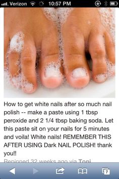 Stained Nails, Catholic Education, Pinterest Nails, Age Gracefully, Pinterest Diy, Shellac Nails, Foot Care