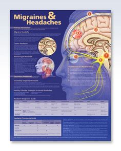 Migraines & Headaches anatomy poster Headache Chart, Cluster Headache, Headache Relief Instant, Migraine Remedies, Remedies For Headaches, Back Ache, Calendula Benefits, Migraine Attack, Headache Types