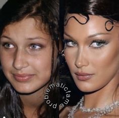 Celebrity Surgery, Haircut For Face Shape, Plastic Surgery Gone Wrong, Celebs Without Makeup, Perfect Nose, Nose Surgery