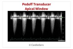 an image of some sound waves with the words peoff transducer optical window