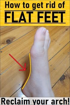 Foot Arch Exercises, Arch Pain In Foot, Flat Foot Exercises, Fallen Arches Exercises, Feet Stretches, Feet Exercise, Flat Feet Exercises, Flat Feet Pain, List Of Exercises