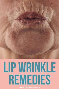 Are you starting to see fine lines form on your upper lip? Rest easy. We’ve compiled the 6 best upper-lip wrinkle treatments. Let the healing begin. Upper Lip Wrinkles, Wrinkles Hands, Wrinkle Remedies, Eliminate Wrinkles, Lip Wrinkles, Upper Lip, Wear Sunscreen, Natural Beauty Tips, How To Line Lips