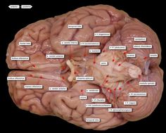 an image of the human brain with labels on each side and arrows pointing to different areas