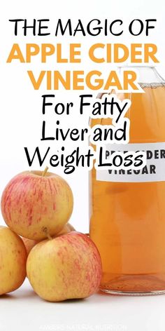 The magic of apple cider vinegar for fatty liver is due to the acetic acid in vinegar. Drinking apple cider vinegar is also good for weight loss, high blood sugar, and diabetes. Fatty liver, weight gain, and diabetes are interconnected, so apple cider vinegar is good for fatty liver and losing weight. Apple cider vinegar is a natural, effective, and inexpensive remedy for liver health. Best Way To Take Apple Cider Vinegar, Vitamins For Liver Health, Liver Remedies, Liver Healing, Apple Cider Vinegar Health, Treating Ibs, Drinking Apple Cider Vinegar