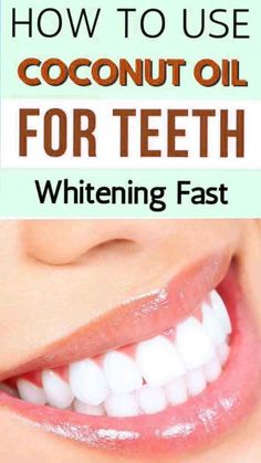 How to Get Pearly White Teeth Naturally and Safely | Must try this hack for super white teeth. 

Learn expert tips for naturally whitening your teeth without harsh chemicals. Achieve a pearly white smile safely and effectively! Dentistry Motivation, Teeth Tips, Nose Picking, Coconut Oil For Teeth, Discolored Teeth