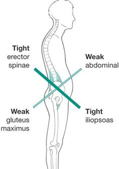 Psoas Release, Hip Problems, Hip Flexor Stretch, Tight Hip Flexors, Psoas Muscle, Hip Flexors, Mobility Exercises