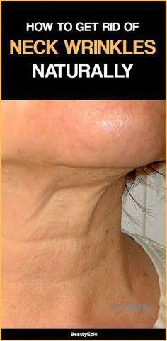 Wrinkle Remedies, Neck Wrinkles, Under Eye Wrinkles, Younger Skin, Saggy Skin, Anti Aging Face, Ageless Beauty, Wrinkle Cream