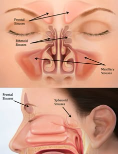 an image of a womans nose showing the location of her sinus and how it works