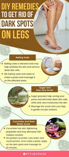 Do you have dark spots on your legs? Read this article to know what causes brown spots on legs and how to remove them and get smooth and clear skin. Dark Spots On Legs, Spots On Legs, Strawberry Legs, Dark Spots On Skin, Spots On Face, Diy Remedies, Remove Dark Spots, Skin Care Recipes