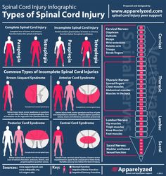 Incomplete spinal cord injury infographic by Apparelyzed. Pt School, Spinal Cord Injuries, Physical Therapist Assistant, Physical Therapy Assistant, Pta School, Pa School, Spinal Injury, Medicine Student, Nursing Tips