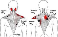 Shoulder Stretches, Stiff Neck, Upper Back Pain, Trigger Point, Trigger Points