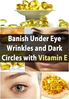 Genius Frugal Beauty Treatment: Banish Under Eye Wrinkles and Dark Circles with Vitamin E Eye Wrinkles, Anti Aging Creme, Diy Kosmetik, Under Eye Wrinkles, Under Eyes, Dark Circle, Eye Wrinkle, Under Eye Bags