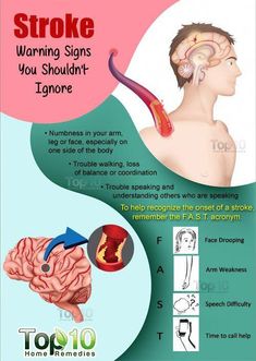 Learn about the warning signs, risk factors, prevention, and diagnosis of stroke. Also, know about the expert tips while taking care of a patient. Top 10 Home Remedies, Loss Of Balance, Blood Pressure Chart, Blood Pressure Diet, Sendai, Productivity Hacks, Signs And Symptoms, Health Info