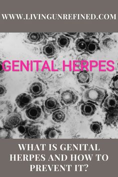 Genital herpes is a common sexually transmitted infection. Today we’ll tell you about a few ways to prevent it. Genital herpes is a sexually transmitted infection. Today, it is a major public health problem. However, this is a sexually transmitted infection that is easy to prevent if you take a number of measures during your sexual intercourses. Public Health, Health Problems