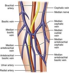 Phlebotomy Notes, Phlebotomy Pictures and diagrams, Phlebotomy Written notes. Phlebotomy Student, Blood Sport, Lab Scientist, Doppler Ultrasound, Lab Assistant, Vascular Ultrasound