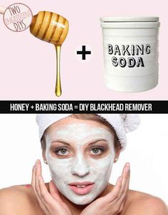 <b>You'll love all the time and money you'll save with these super simple DIY projects.</b> Baking Soda And Honey, Remove Blackheads From Nose, Blackhead Remedies, Baking Soda Face, Blackheads Removal, Face Scrub Homemade, For Blackheads