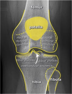 Knee Anatomy, Radiology Schools, Medical Radiography, Radiology Student, Radiology Technician, Radiology Imaging, Anatomy Bones, Perfect Handwriting, Basic Anatomy And Physiology