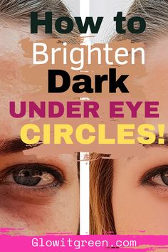 Get the best tips to remove and brighten the dark circles around your eyes from glowitgreen.com! Simple hacks and ideas done consistently can yield incredible results to illuminate this area!! Healthy Routines, Natural Beauty Remedies, Natural Beauty Diy